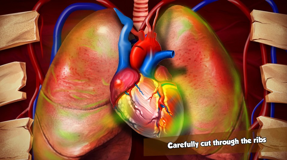 模拟心脏手术-插图1