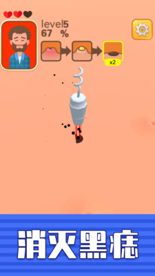 挤痘贼爽-插图1