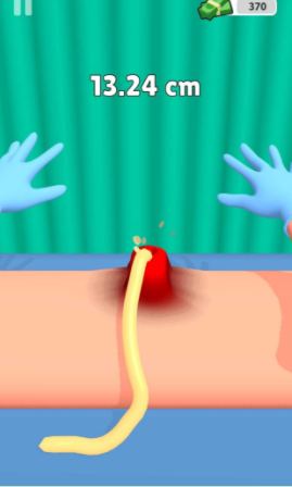 粉刺挤压 粉刺挤压