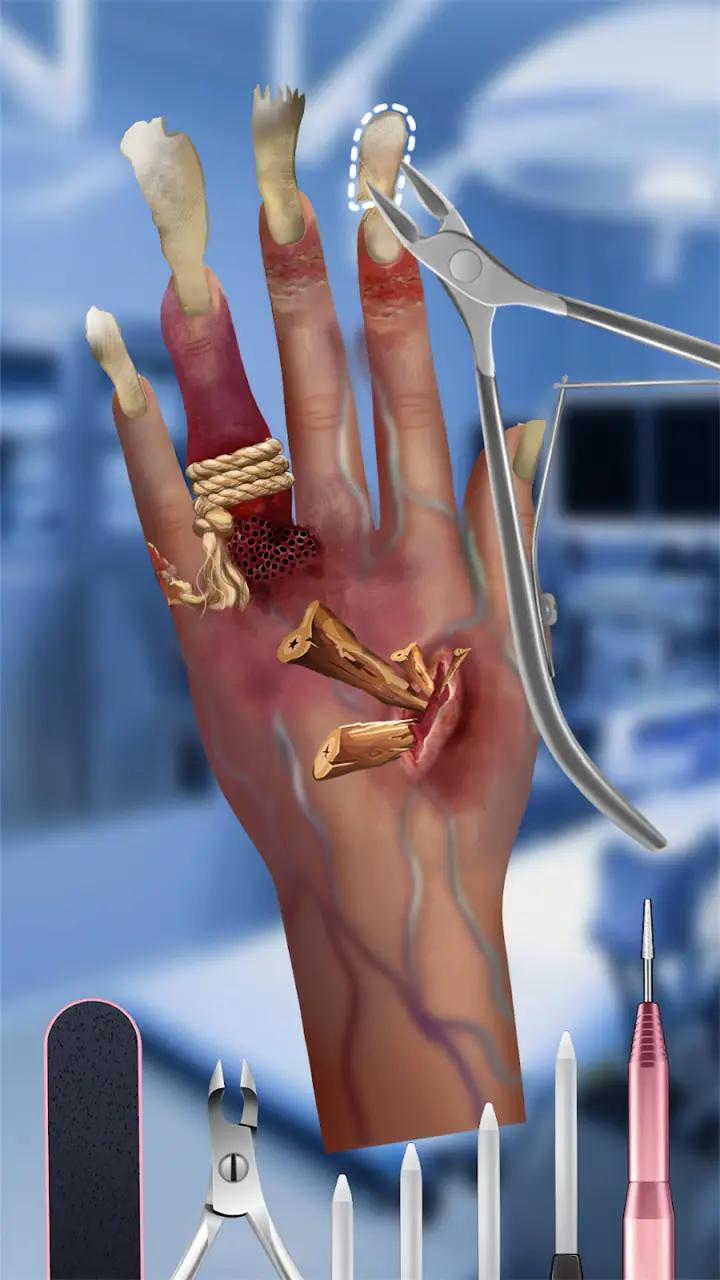 粉刺达人 粉刺达人