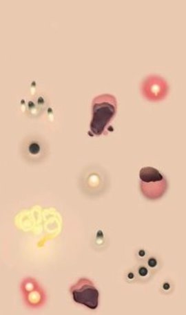 挤痘痘达人 挤痘痘达人