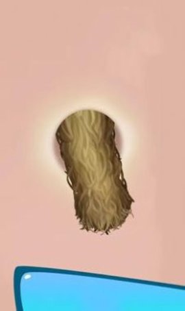 挤痘痘达人 挤痘痘达人