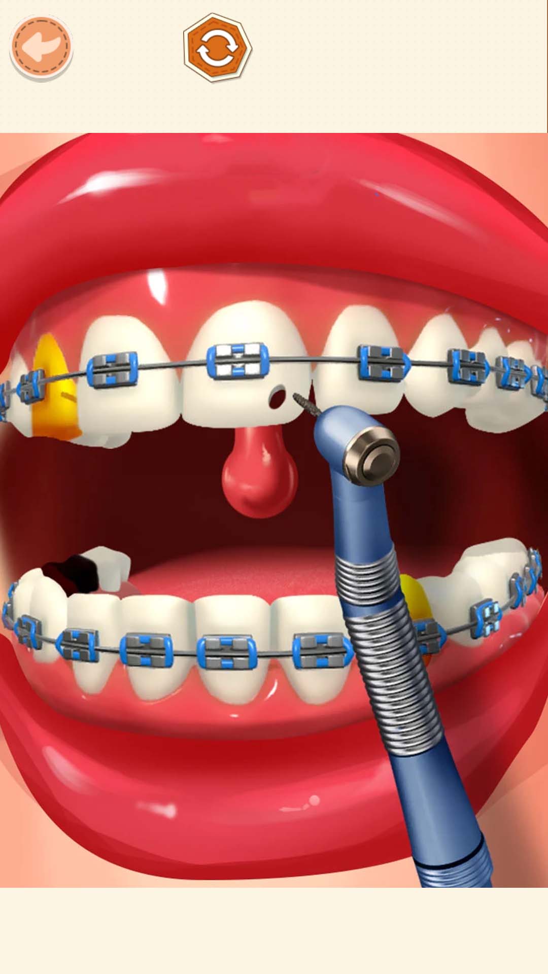 高级医生模拟 高级医生模拟